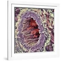 Artery SEM-Steve Gschmeissner-Framed Photographic Print