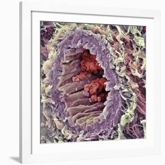 Artery SEM-Steve Gschmeissner-Framed Photographic Print