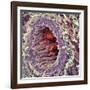 Artery SEM-Steve Gschmeissner-Framed Photographic Print