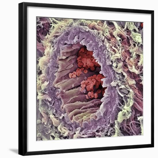 Artery SEM-Steve Gschmeissner-Framed Photographic Print