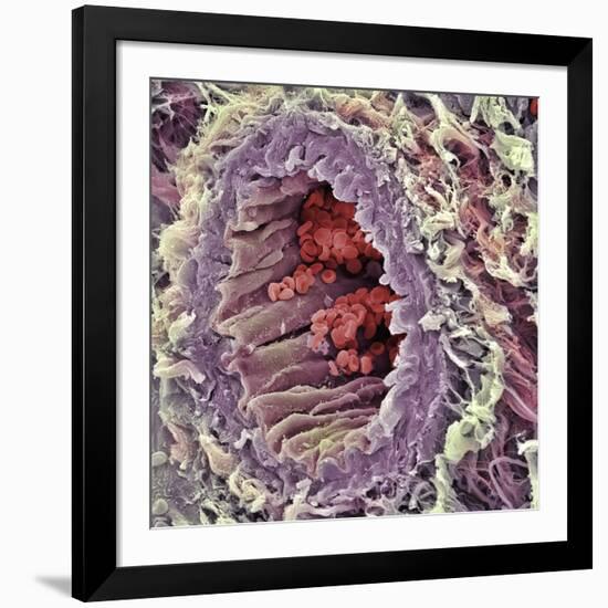 Artery SEM-Steve Gschmeissner-Framed Photographic Print