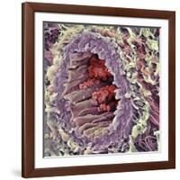 Artery SEM-Steve Gschmeissner-Framed Photographic Print