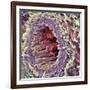 Artery SEM-Steve Gschmeissner-Framed Photographic Print