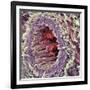 Artery SEM-Steve Gschmeissner-Framed Photographic Print