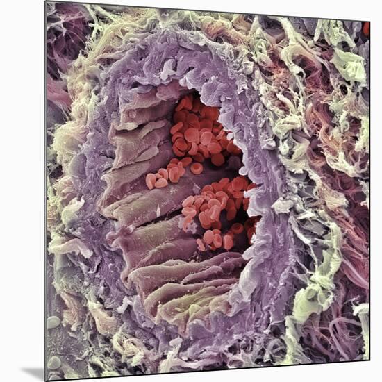 Artery SEM-Steve Gschmeissner-Mounted Photographic Print