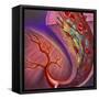 Artery Showing Atherosclerotic Plaque, Platelets and Red Blood Cells-null-Framed Stretched Canvas