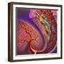 Artery Showing Atherosclerotic Plaque, Platelets and Red Blood Cells-null-Framed Art Print