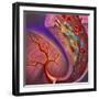 Artery Showing Atherosclerotic Plaque, Platelets and Red Blood Cells-null-Framed Art Print