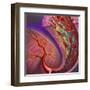 Artery Showing Atherosclerotic Plaque, Platelets and Red Blood Cells-null-Framed Art Print