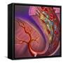 Artery Showing Atherosclerotic Plaque, Platelets and Red Blood Cells-null-Framed Stretched Canvas