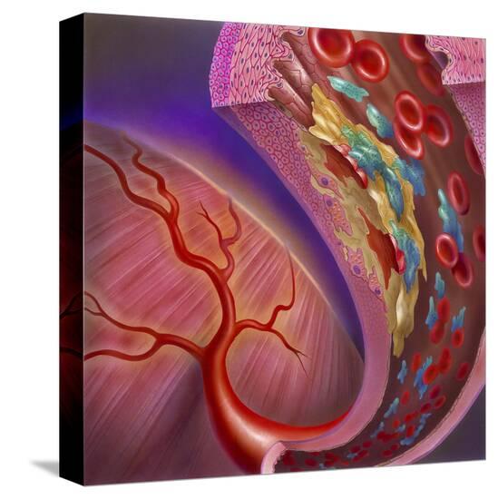 Stretched Canvas Print, , large