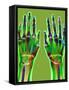 Arthritic Hands, X-ray-Du Cane Medical-Framed Stretched Canvas