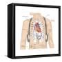 Artificial Pacemaker. Cardiovascular Disease, Cardiovascular System, Heart, Health and Disease-Encyclopaedia Britannica-Framed Stretched Canvas
