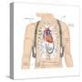 Artificial Pacemaker. Cardiovascular Disease, Cardiovascular System, Heart, Health and Disease-Encyclopaedia Britannica-Stretched Canvas