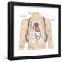 Artificial Pacemaker. Cardiovascular Disease, Cardiovascular System, Heart, Health and Disease-Encyclopaedia Britannica-Framed Poster