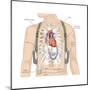 Artificial Pacemaker. Cardiovascular Disease, Cardiovascular System, Heart, Health and Disease-Encyclopaedia Britannica-Mounted Poster