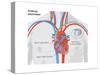 Artificial Pacemaker-Encyclopaedia Britannica-Stretched Canvas