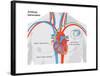 Artificial Pacemaker-Encyclopaedia Britannica-Framed Poster