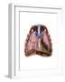 Artist Depiction of Mesothelioma in the Lungs-Abdominal Cavity-null-Framed Art Print