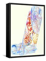 Artwork of Asthmatic Respiratory System on Inhaler-John Bavosi-Framed Stretched Canvas