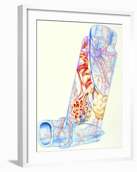 Artwork of Asthmatic Respiratory System on Inhaler-John Bavosi-Framed Photographic Print