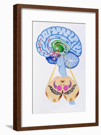 Artwork of Brain Areas In Parkinson's Disease.-John Bavosi-Framed Photographic Print