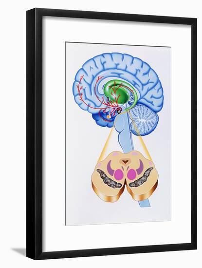 Artwork of Brain Areas In Parkinson's Disease.-John Bavosi-Framed Photographic Print