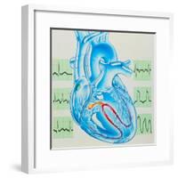 Artwork of Cardiac Arrhythmia with Heart & ECGs-John Bavosi-Framed Premium Photographic Print