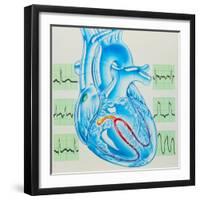 Artwork of Cardiac Arrhythmia with Heart & ECGs-John Bavosi-Framed Premium Photographic Print