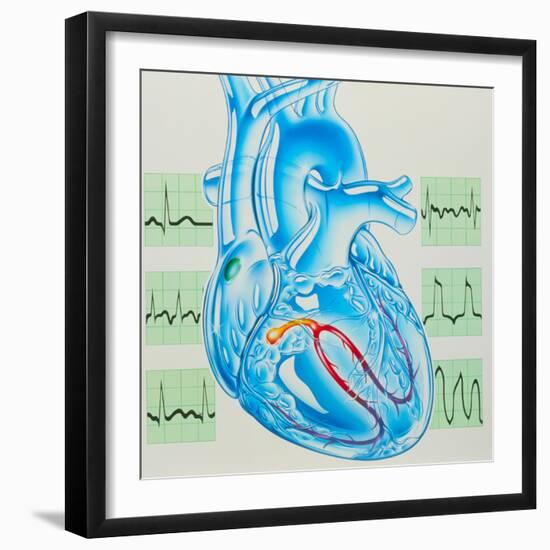 Artwork of Cardiac Arrhythmia with Heart & ECGs-John Bavosi-Framed Premium Photographic Print