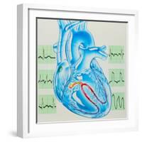 Artwork of Cardiac Arrhythmia with Heart & ECGs-John Bavosi-Framed Premium Photographic Print