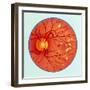 Artwork of Diabetic Retinopathy Ophthalmoscope View-John Bavosi-Framed Premium Photographic Print