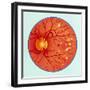 Artwork of Diabetic Retinopathy Ophthalmoscope View-John Bavosi-Framed Premium Photographic Print