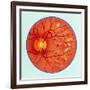 Artwork of Diabetic Retinopathy Ophthalmoscope View-John Bavosi-Framed Photographic Print