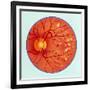 Artwork of Diabetic Retinopathy Ophthalmoscope View-John Bavosi-Framed Photographic Print