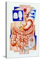 Artwork of Human Intestines And Colostomy-John Bavosi-Stretched Canvas