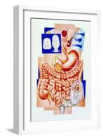 Artwork of Human Intestines And Colostomy-John Bavosi-Framed Photographic Print