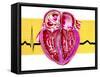 Artwork of Sectioned Heart with Healthy ECG Trace-John Bavosi-Framed Stretched Canvas