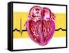 Artwork of Sectioned Heart with Healthy ECG Trace-John Bavosi-Framed Stretched Canvas