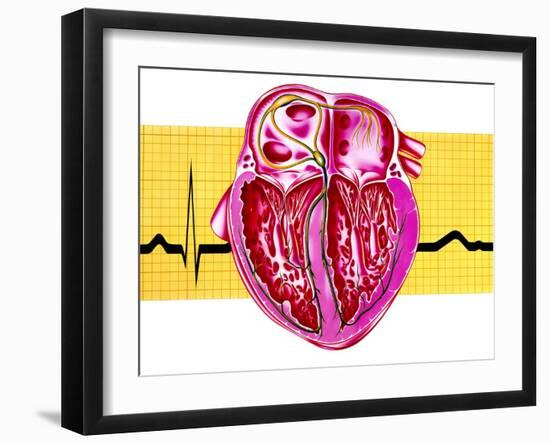 Artwork of Sectioned Heart with Healthy ECG Trace-John Bavosi-Framed Photographic Print