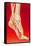 Artwork Showing Calcaneal Spur And Foot Pain-John Bavosi-Framed Stretched Canvas