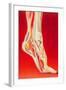 Artwork Showing Calcaneal Spur And Foot Pain-John Bavosi-Framed Premium Photographic Print