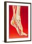 Artwork Showing Calcaneal Spur And Foot Pain-John Bavosi-Framed Premium Photographic Print