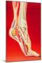 Artwork Showing Calcaneal Spur And Foot Pain-John Bavosi-Mounted Premium Photographic Print