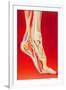 Artwork Showing Calcaneal Spur And Foot Pain-John Bavosi-Framed Photographic Print