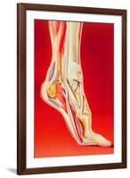 Artwork Showing Calcaneal Spur And Foot Pain-John Bavosi-Framed Photographic Print