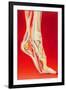 Artwork Showing Calcaneal Spur And Foot Pain-John Bavosi-Framed Photographic Print