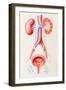 Artwork Showing Cystitis Leading To Pyelonephritis-John Bavosi-Framed Photographic Print