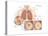 Asthma Attack-Encyclopaedia Britannica-Stretched Canvas