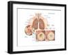 Asthma Attack-Encyclopaedia Britannica-Framed Art Print